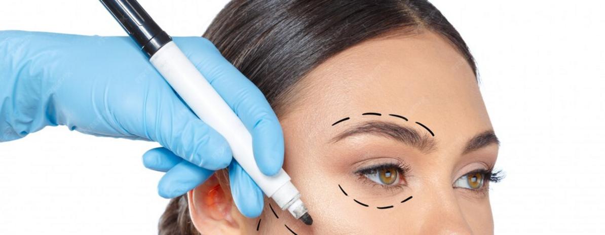 Cirugía Facial