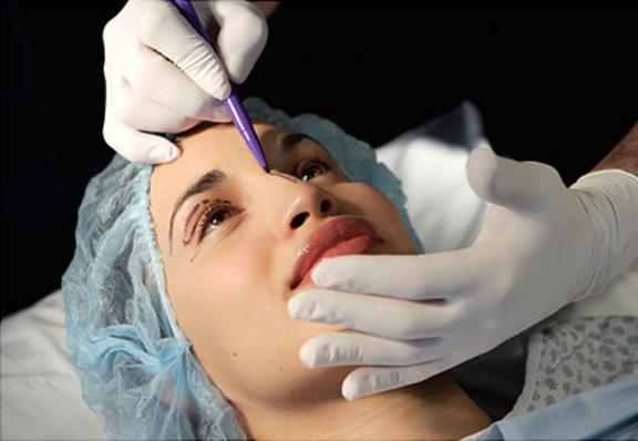 Rinoplastia - Nariz